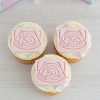 Set of 2 Pregnancy Ultrasound & 20 Week Fetal Baby Mini Cookie Cutter & Stamp Set