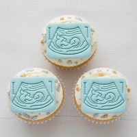 Set of 2 Pregnancy Ultrasound & 20 Week Fetal Baby Mini Cookie Cutter & Stamp Set