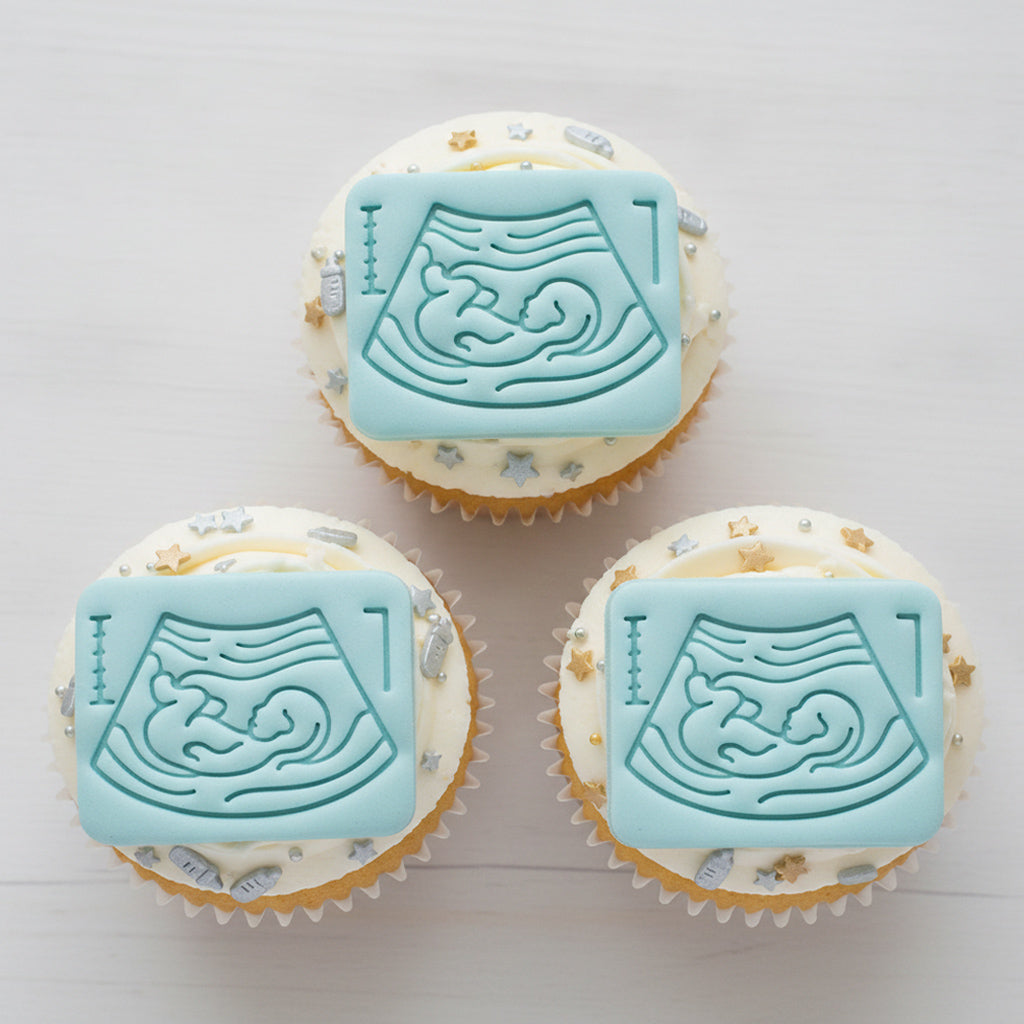 Set of 2 Pregnancy Ultrasound & 20 Week Fetal Baby Mini Cookie Cutter & Stamp Set