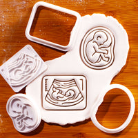 Set of 2 Pregnancy Ultrasound & 20 Week Fetal Baby Mini Cookie Cutter & Stamp Set